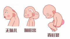 孕期怎么补叶酸？内江市妇幼保健院产科医生手把手教您！