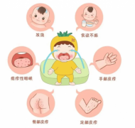 怎么预防儿童手足口病？内江妇幼儿科专家表示要做好这几点！